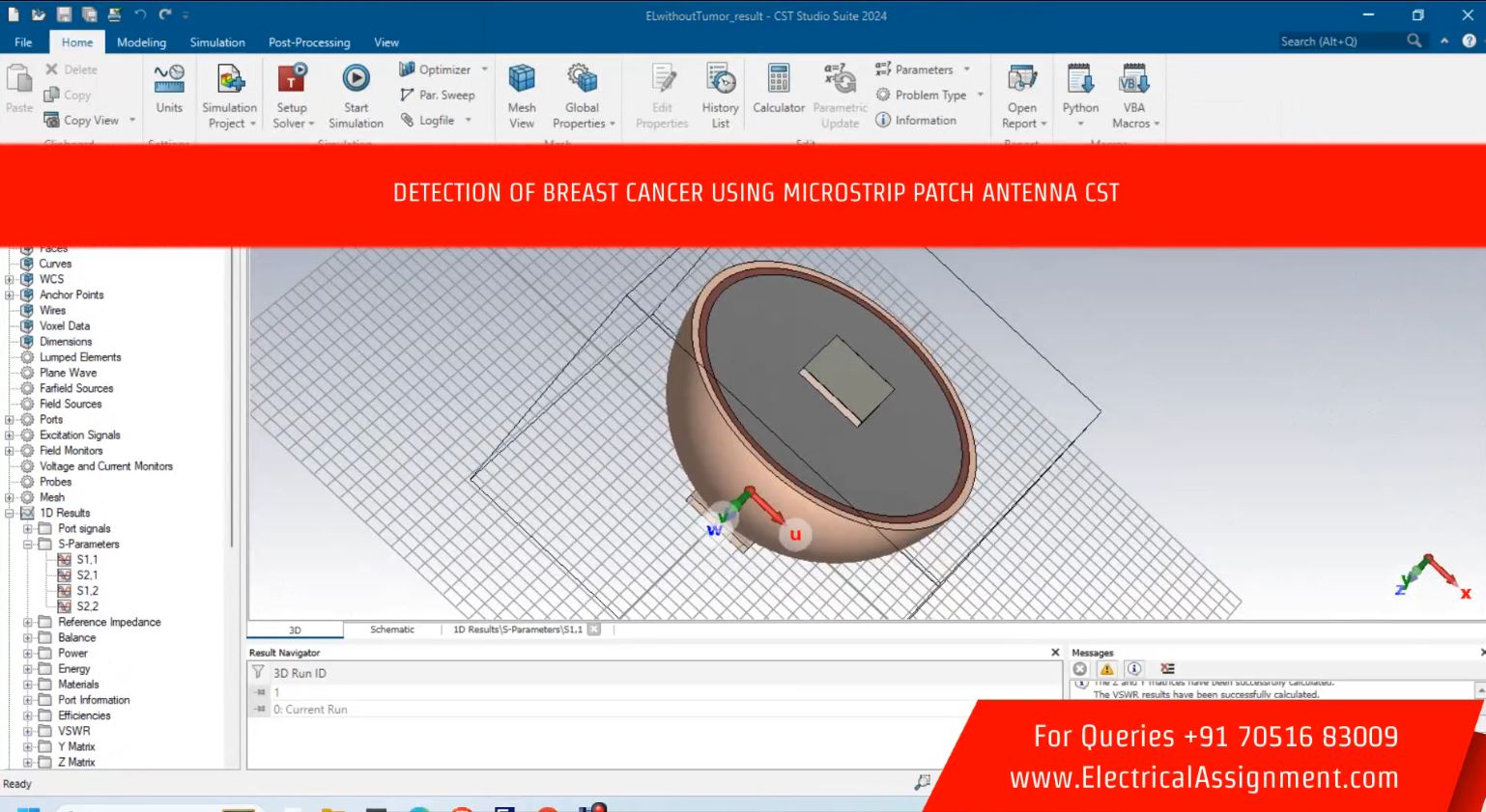 Design and implementation of flexible wearable antenna on thyroid gland in the detection of cancer cells screenshot 7